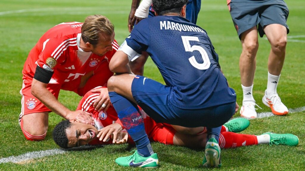 Neuer criticizes Donnarumma after Musiala injury in Bayern loss